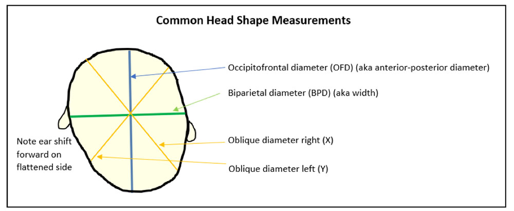 Drawing showing Common Head Shape Measurements with labels